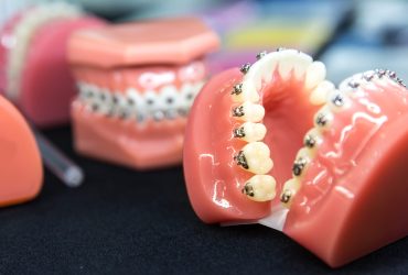 Orthodontics