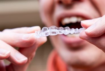 Invisalign